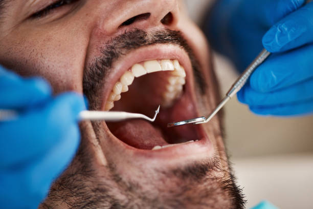 Best After-Hours Emergency Dentist in Jefferson, OH